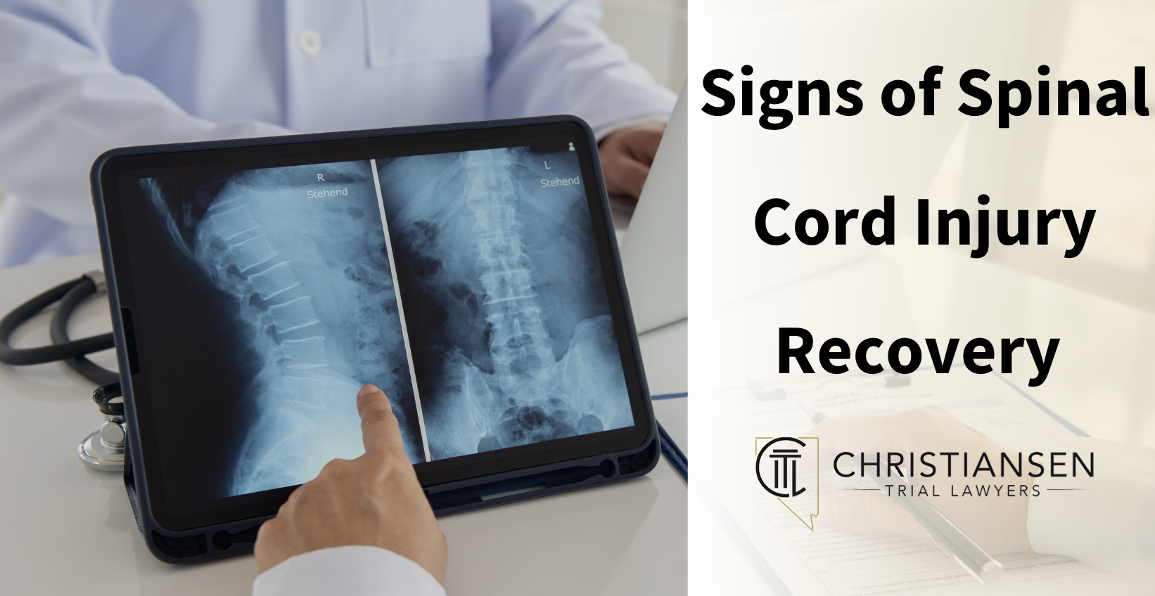 Signs of Spinal Cord Injury Recovery